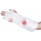 Obvaz poraněná ruka s krví